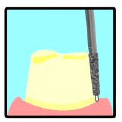 Margin Refinement