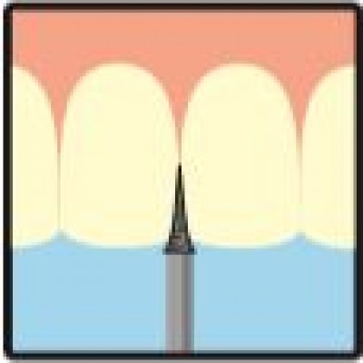 Interdental 
